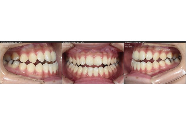458e2808fe41b173755aed5a4be3382b_1688973051_7617.jpg